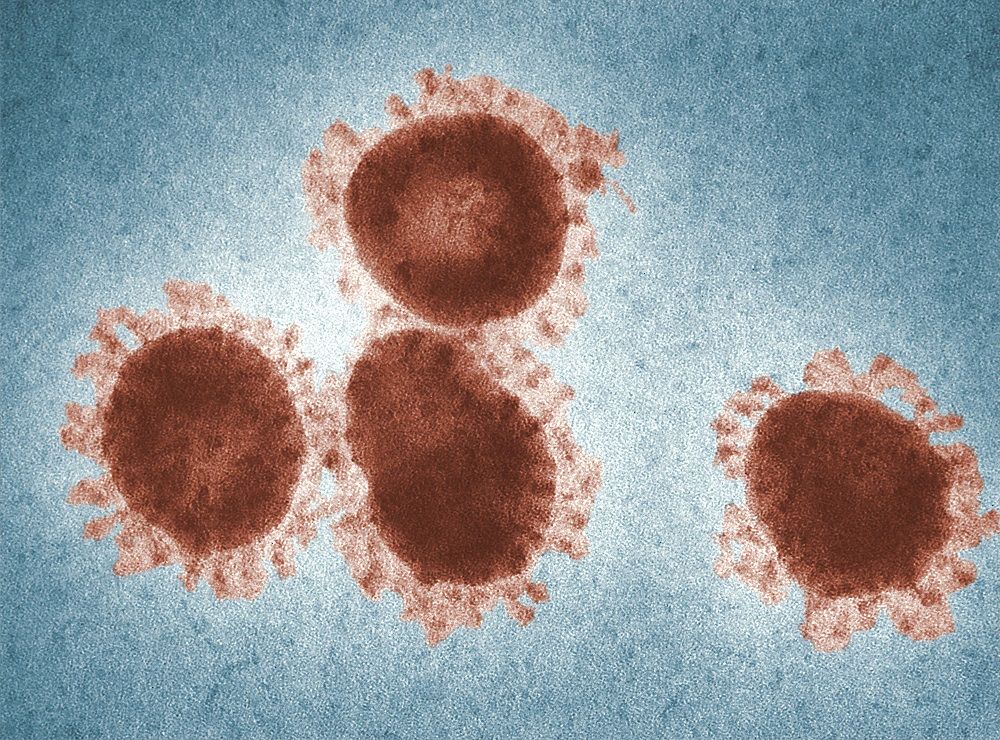 You Need This: Good News About the Coronavirus